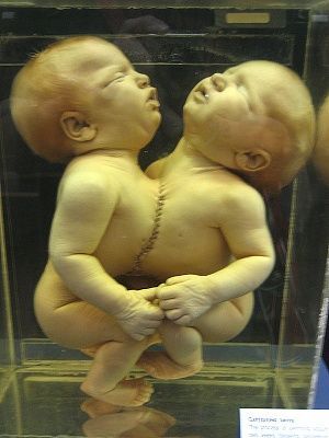 skeletonbabies10.jpg