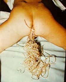 roundworms-th.jpg
