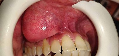img_20230409_000926_204.jpg