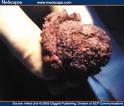 penile-carcinoma.jpg