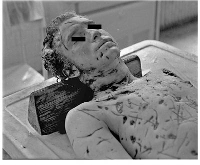 scratches-lacerations-along-fatal-bites-neck.jpg