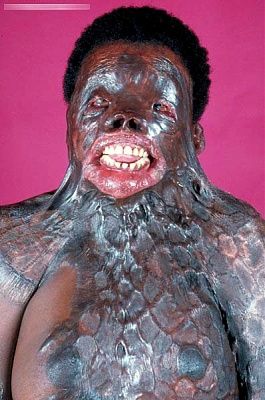 12266-horrific-afflictions-these-poor-africansbig2.jpg