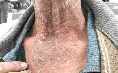 krokodil_6.jpg
