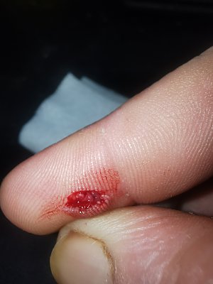 16_08_2023-finger1.jpg