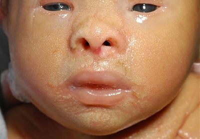 collodionface.jpg