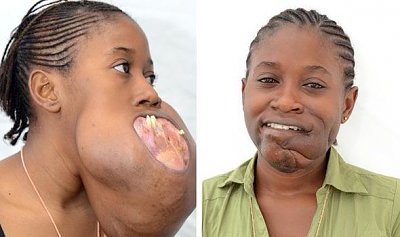 football-sized-tumour-life-changing-surgery-flaoting-hospital-519867.jpg