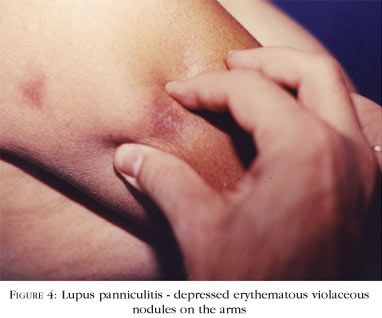 en_a02fig04.jpg