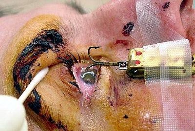 skull-cracked-open-train-04-500x375.jpg