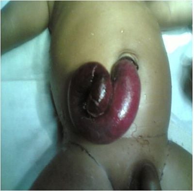 bellybutton-bowel.jpg