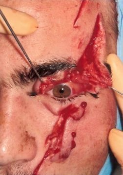 chainsaw-kickback.jpg