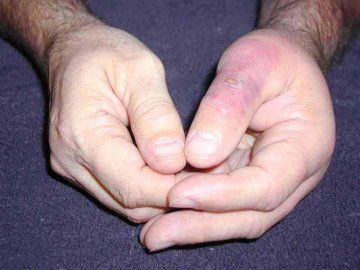 img_BRS_thumb_day_3.jpg