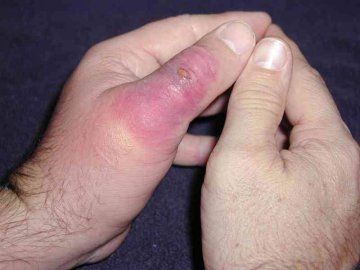 img_BRS_thumb_day_4.jpg
