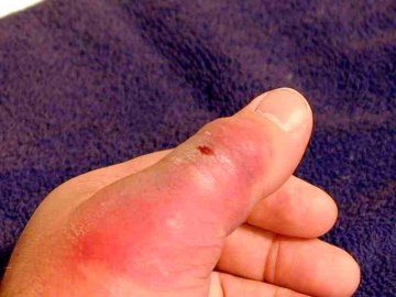 img_BRS_thumb_day_5.jpg