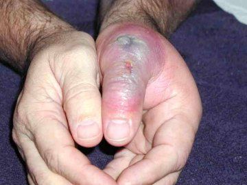 img_BRS_thumb_day_6.jpg