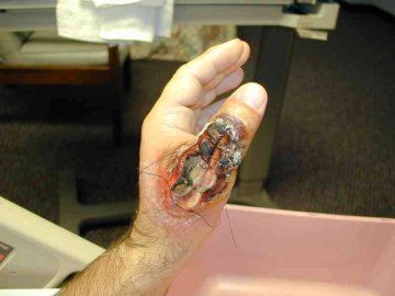 img_BRS_thumb_day_9.jpg