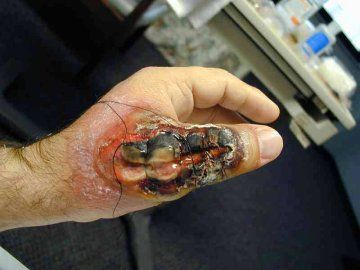 img_BRS_thumb_day_10.jpg