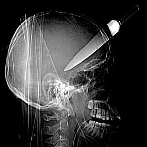 xray2.jpg