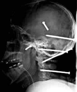 xray4.jpg