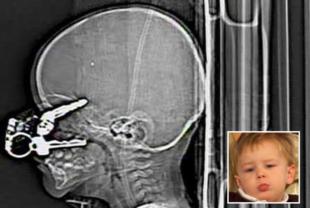 xrayheader.jpg