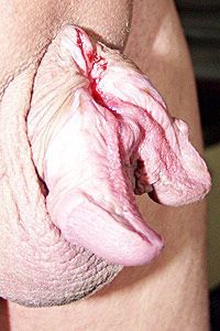 splitpenis2.jpg