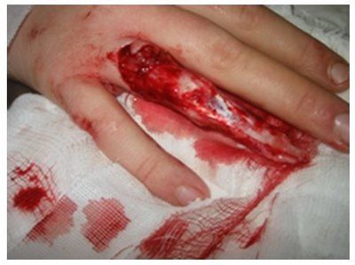 ring-fig1.jpg