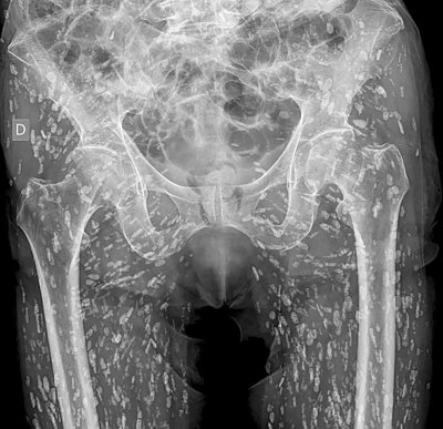 xray.jpg