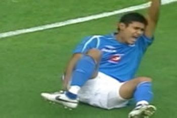 worstsoccerinjuryever_display_image.jpg