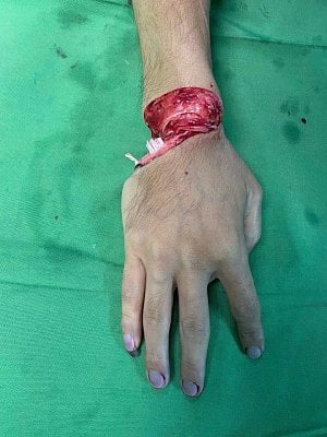 wrist1.jpg