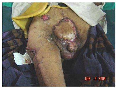 bladder-fig5.jpg