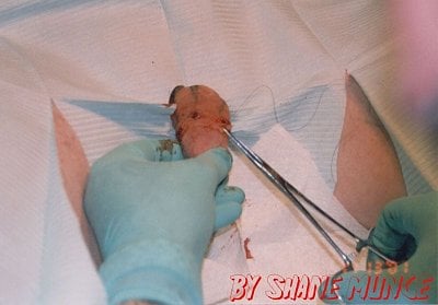implant-bead01.jpg