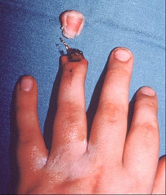 ouch-.jpg