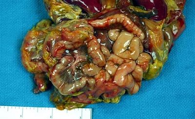 case2008106image2.jpg