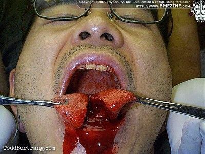 tongue2.jpg