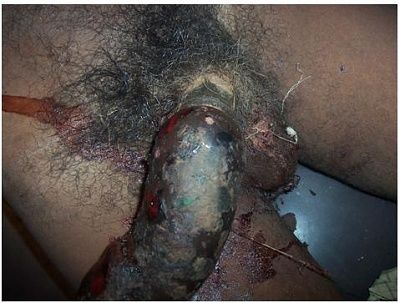 penile-fig1.jpg