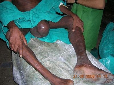 swelling-fig1.jpg