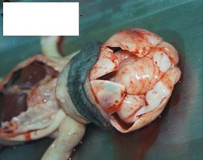 fetus-4.jpg