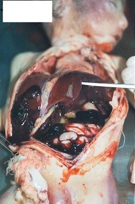 fetus-5.jpg