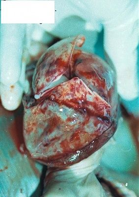 fetus-6.jpg