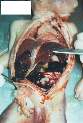 fetus-7.jpg