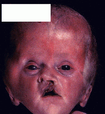 10.gif
