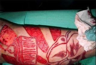 skin_tattoo_ouch.jpg