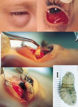 worm-in-eye.jpg