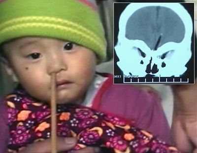 wabc_chopstick_ax3_100105_ssh.jpg