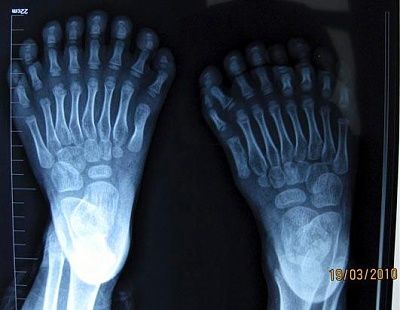 rt_china_xray_feet_100323_ssh.jpg