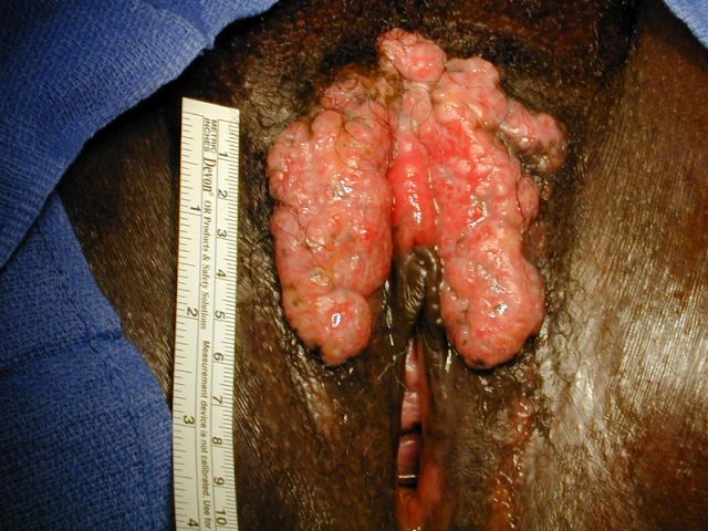case200653gross.jpg
