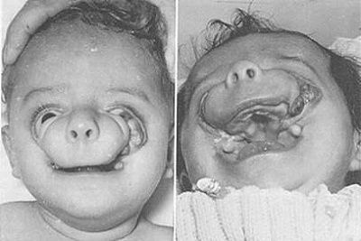 baby27.jpg