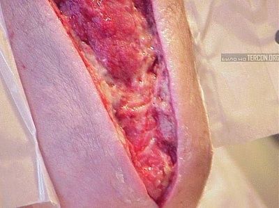 arm-pastrami.jpg
