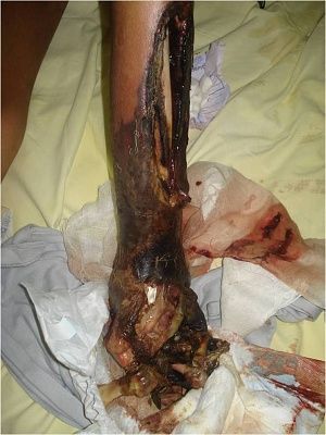 simborio-leg-2.jpg