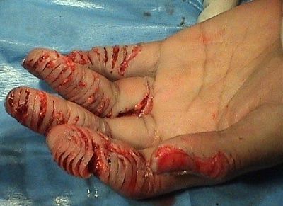 ouch1.jpg