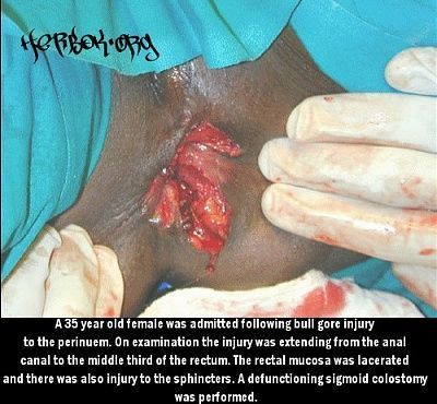 gore1.jpg